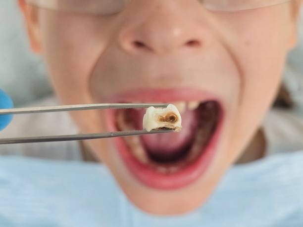 Best Emergency Gum Treatment in Brownsville, TX