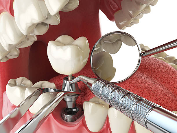 Best Emergency Denture Repair in Brownsville, TX